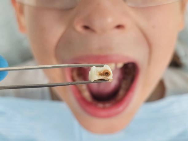 Best Pediatric Emergency Dentist in Grove City, PA